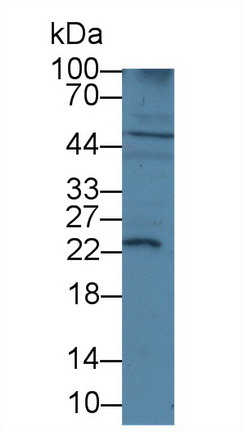 Polyclonal Antibody to Insulin Like Growth Factor 1 (IGF1)