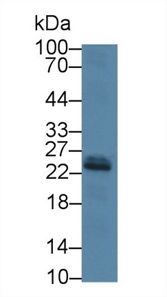 Polyclonal Antibody to Insulin Like Growth Factor 1 (IGF1)