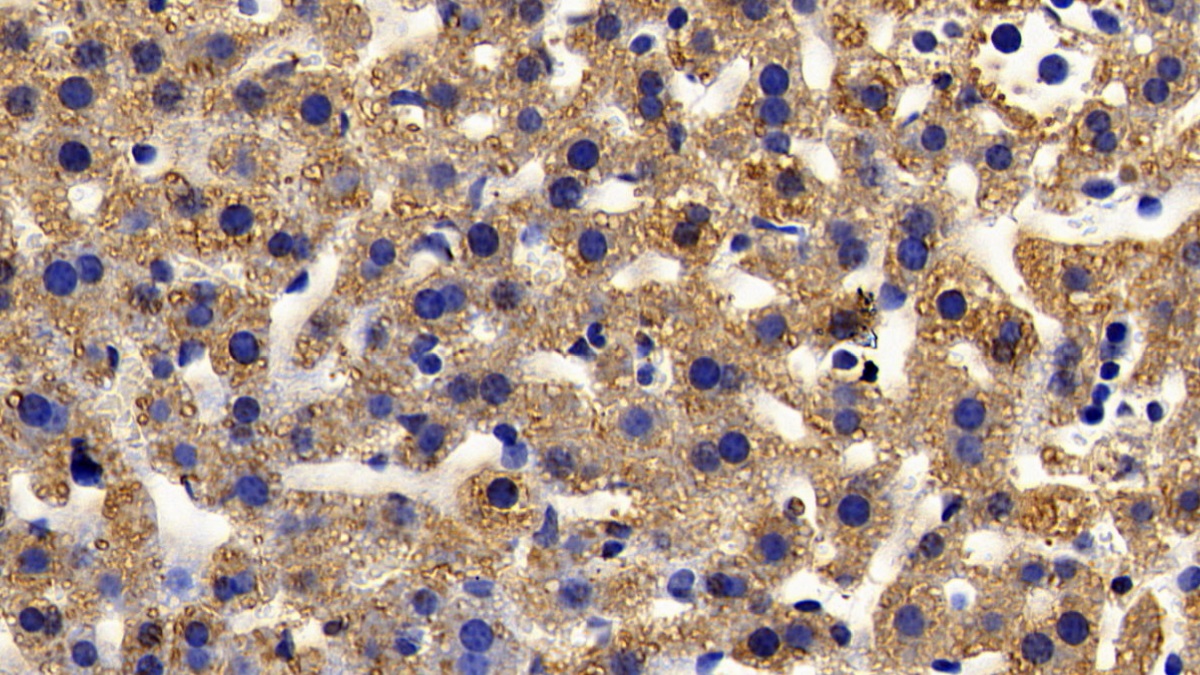 Polyclonal Antibody to Insulin Like Growth Factor 1 (IGF1)