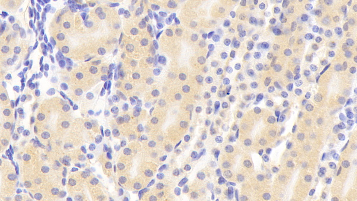 Polyclonal Antibody to Insulin Like Growth Factor 1 (IGF1)