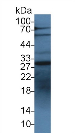 Polyclonal Antibody to Insulin Like Growth Factor Binding Protein 1 (IGFBP1)