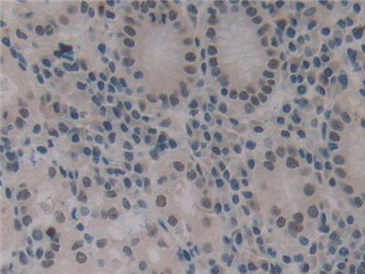 Polyclonal Antibody to Insulin Like Growth Factor Binding Protein 1 (IGFBP1)