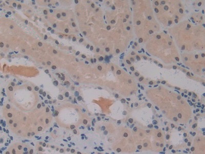 Polyclonal Antibody to Insulin Like Growth Factor Binding Protein 1 (IGFBP1)