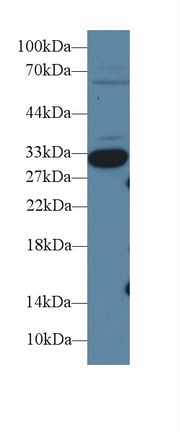 Polyclonal Antibody to Insulin Like Growth Factor Binding Protein 1 (IGFBP1)