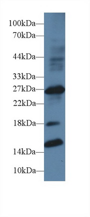 Polyclonal Antibody to Insulin Like Growth Factor Binding Protein 1 (IGFBP1)