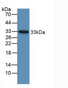 Polyclonal Antibody to Insulin Like Growth Factor Binding Protein 2 (IGFBP2)