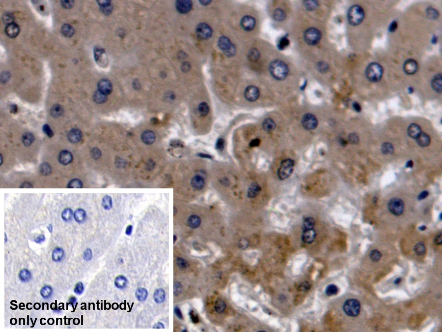 Polyclonal Antibody to Insulin Like Growth Factor Binding Protein 2 (IGFBP2)