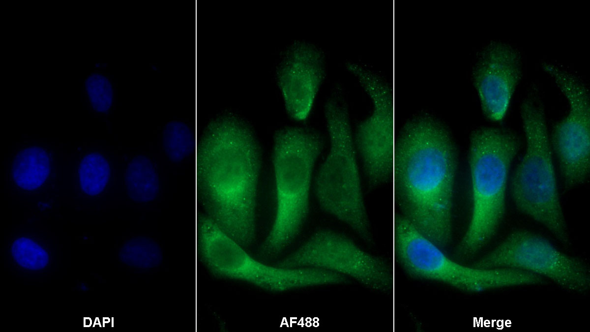 Polyclonal Antibody to Insulin Like Growth Factor Binding Protein 2 (IGFBP2)