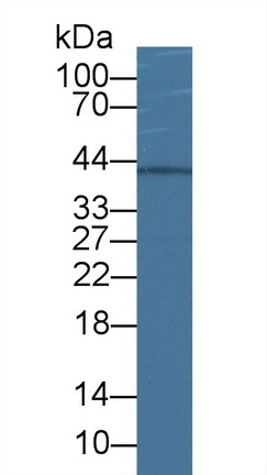 Polyclonal Antibody to Insulin Like Growth Factor Binding Protein 3 (IGFBP3)