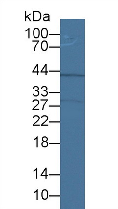 Polyclonal Antibody to Insulin Like Growth Factor Binding Protein 3 (IGFBP3)