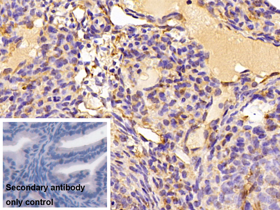 Polyclonal Antibody to Insulin Like Growth Factor Binding Protein 4 (IGFBP4)