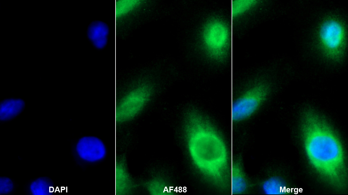 Polyclonal Antibody to Insulin Like Growth Factor Binding Protein 4 (IGFBP4)