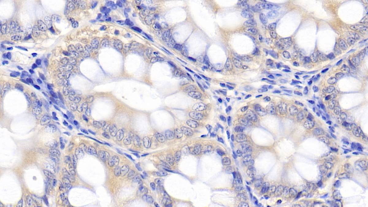 Polyclonal Antibody to Interleukin 10 (IL10)