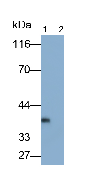 Polyclonal Antibody to Interleukin 12B (IL12B)