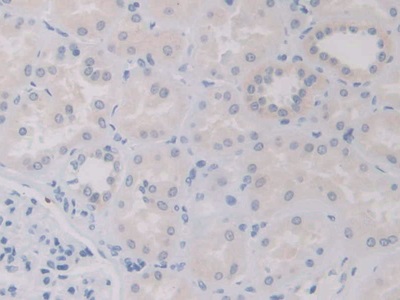 Polyclonal Antibody to Interleukin 12A (IL12A)