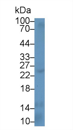 Polyclonal Antibody to Interleukin 12A (IL12A)