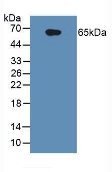 Polyclonal Antibody to Interleukin 1 Receptor Type I (IL1R1)