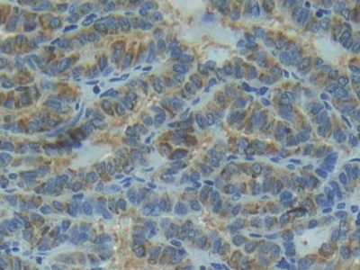 Polyclonal Antibody to Interleukin 1 Receptor Type I (IL1R1)