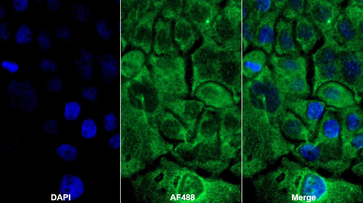 Polyclonal Antibody to Interleukin 1 Receptor Type I (IL1R1)