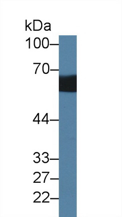 Polyclonal Antibody to Interleukin 1 Receptor Type I (IL1R1)