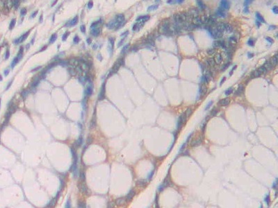 Polyclonal Antibody to Interleukin 1 Receptor Type I (IL1R1)