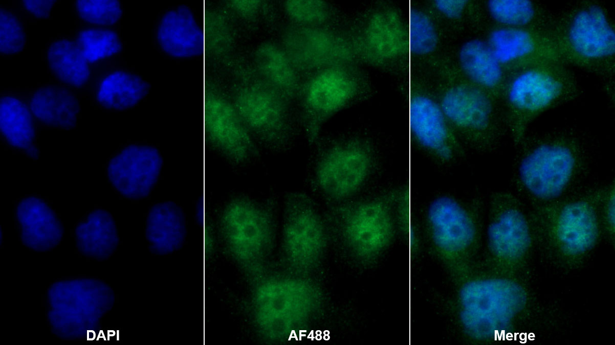 Polyclonal Antibody to Interleukin 1 Receptor Type I (IL1R1)