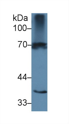 Polyclonal Antibody to Interleukin 1 Receptor Type I (IL1R1)