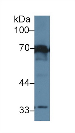 Polyclonal Antibody to Interleukin 1 Receptor Type I (IL1R1)