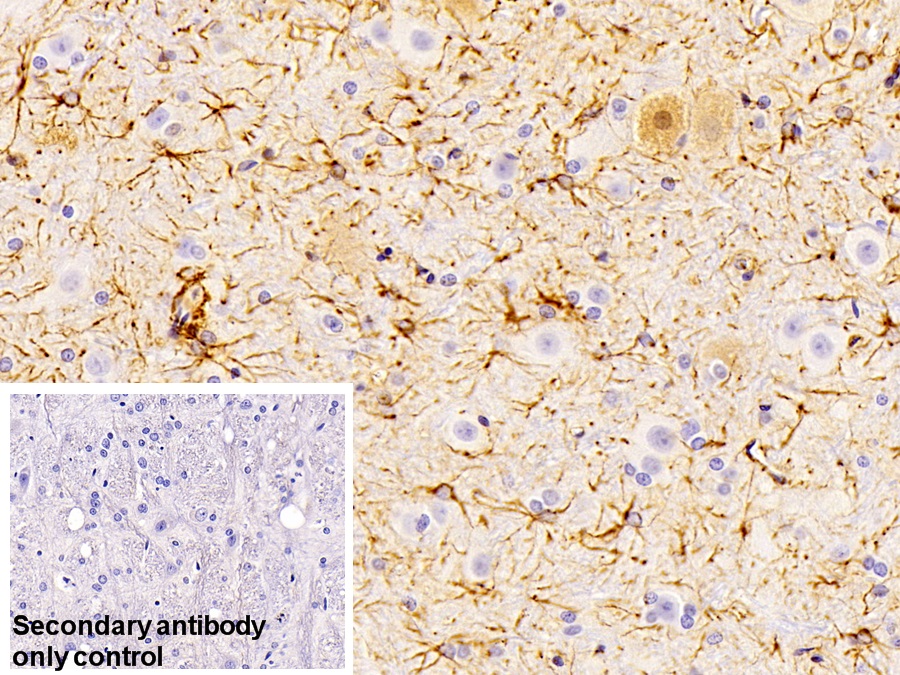 Polyclonal Antibody to Glial Fibrillary Acidic Protein (GFAP)