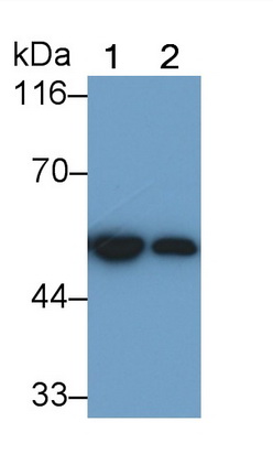 Polyclonal Antibody to Glial Fibrillary Acidic Protein (GFAP)