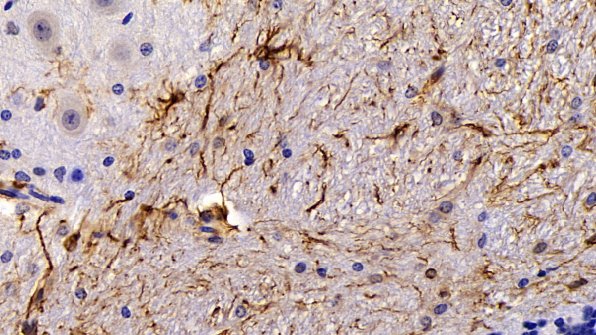 Polyclonal Antibody to Glial Fibrillary Acidic Protein (GFAP)