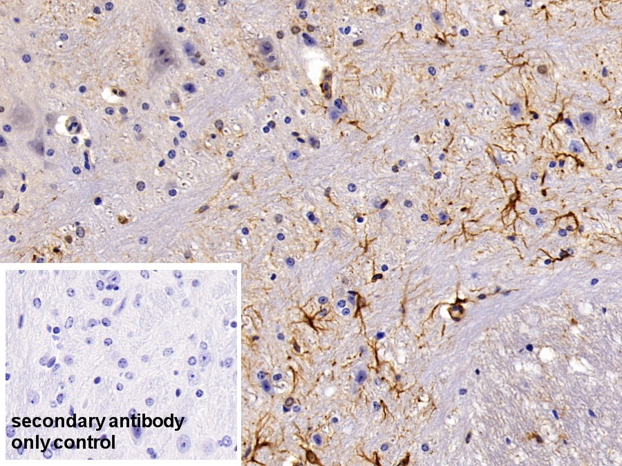 Polyclonal Antibody to Glial Fibrillary Acidic Protein (GFAP)