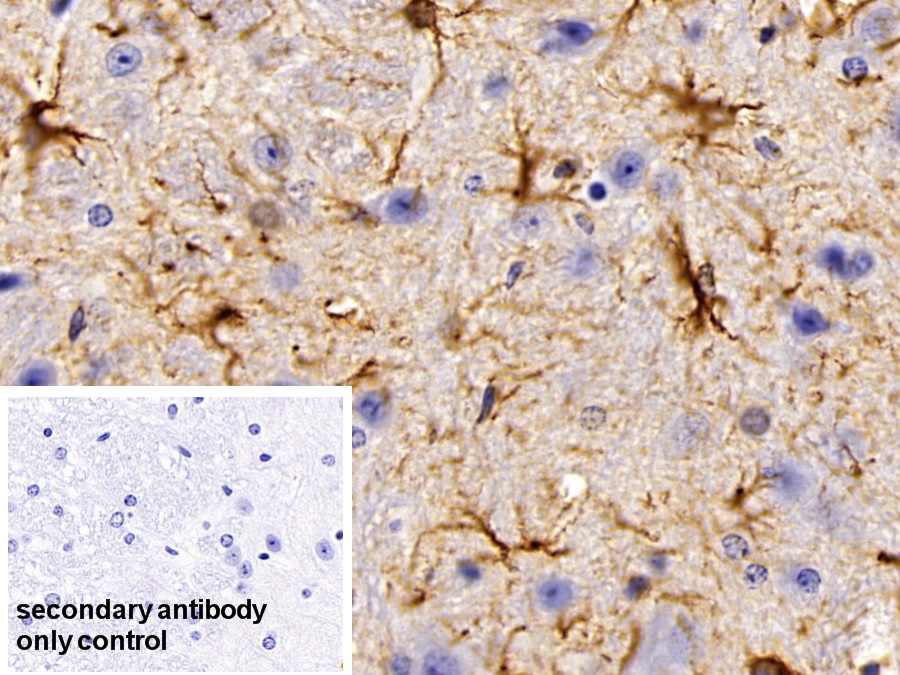 Polyclonal Antibody to Glial Fibrillary Acidic Protein (GFAP)