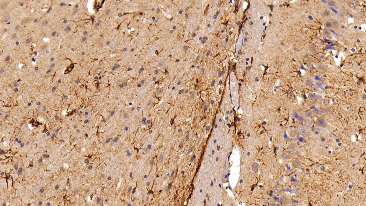 Polyclonal Antibody to Glial Fibrillary Acidic Protein (GFAP)