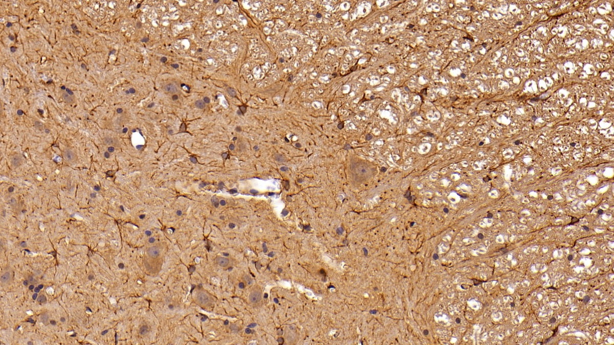 Polyclonal Antibody to Glial Fibrillary Acidic Protein (GFAP)