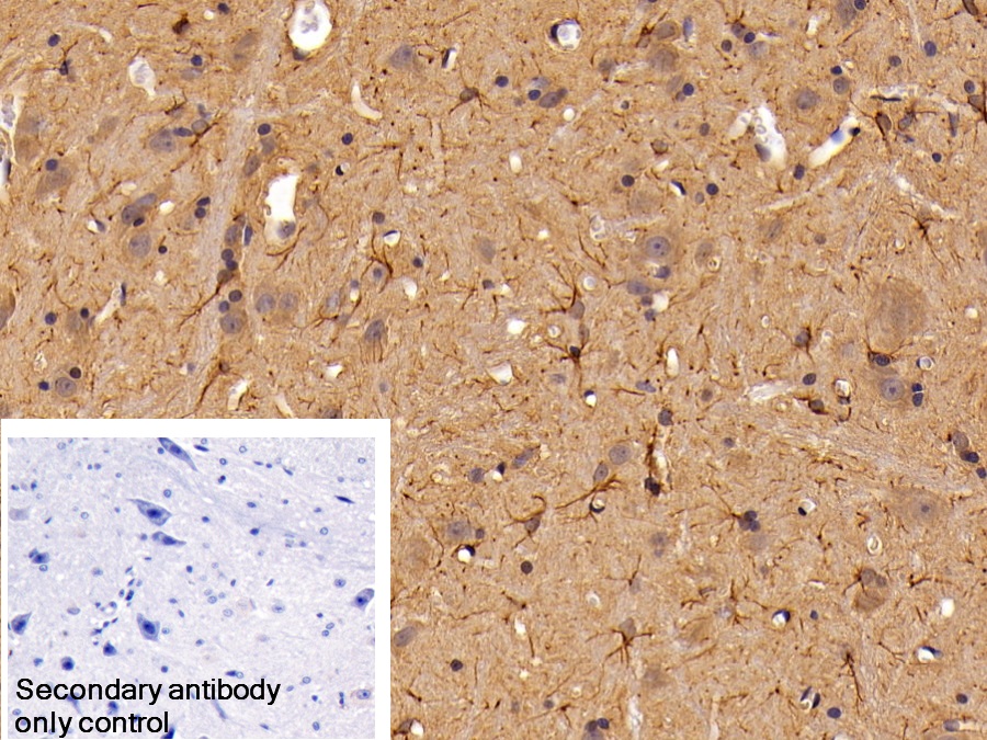 Polyclonal Antibody to Glial Fibrillary Acidic Protein (GFAP)