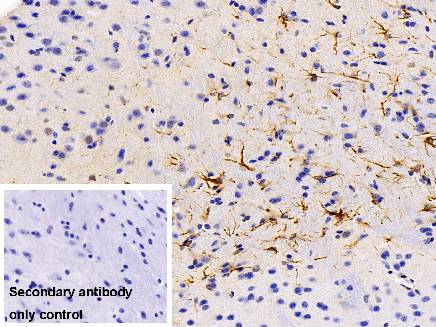 Polyclonal Antibody to Glial Fibrillary Acidic Protein (GFAP)