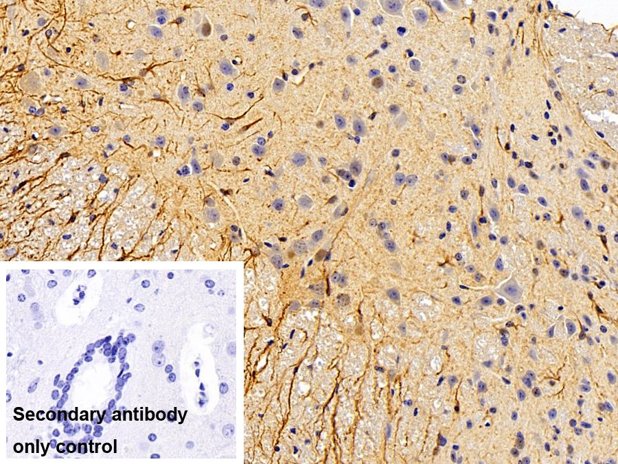 Polyclonal Antibody to Glial Fibrillary Acidic Protein (GFAP)