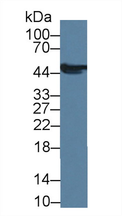 Polyclonal Antibody to Glial Fibrillary Acidic Protein (GFAP)