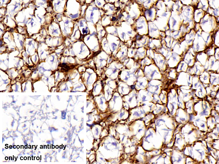 Polyclonal Antibody to Glial Fibrillary Acidic Protein (GFAP)