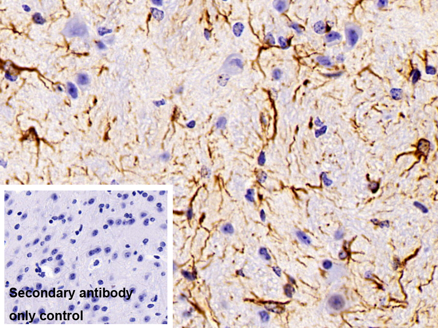 Polyclonal Antibody to Glial Fibrillary Acidic Protein (GFAP)