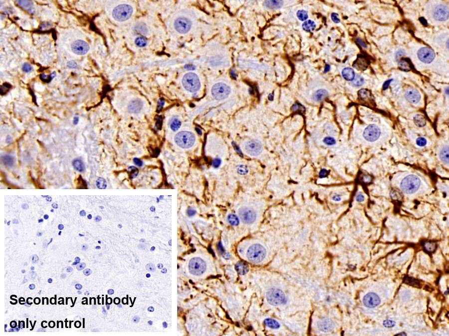 Polyclonal Antibody to Glial Fibrillary Acidic Protein (GFAP)