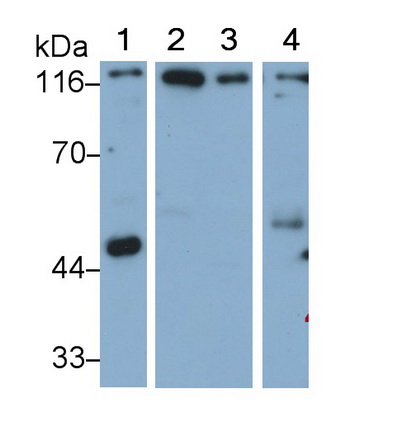 Polyclonal Antibody to Meningioma Expressed Antigen 5 (MGEA5)