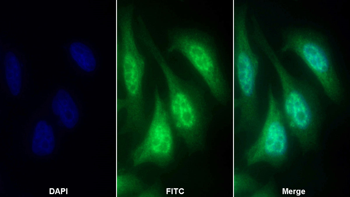 Polyclonal Antibody to Meningioma Expressed Antigen 5 (MGEA5)