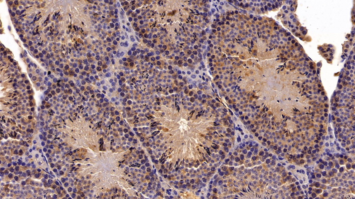 Polyclonal Antibody to Meningioma Expressed Antigen 5 (MGEA5)