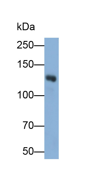 Polyclonal Antibody to Meningioma Expressed Antigen 5 (MGEA5)