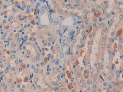 Polyclonal Antibody to Meningioma Expressed Antigen 5 (MGEA5)