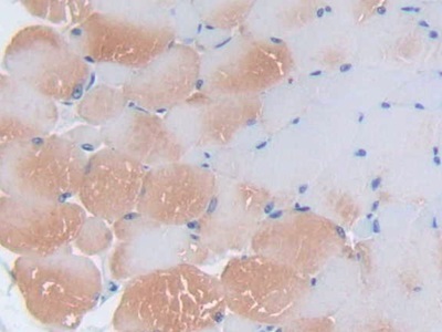 Polyclonal Antibody to Interleukin 2 (IL2)