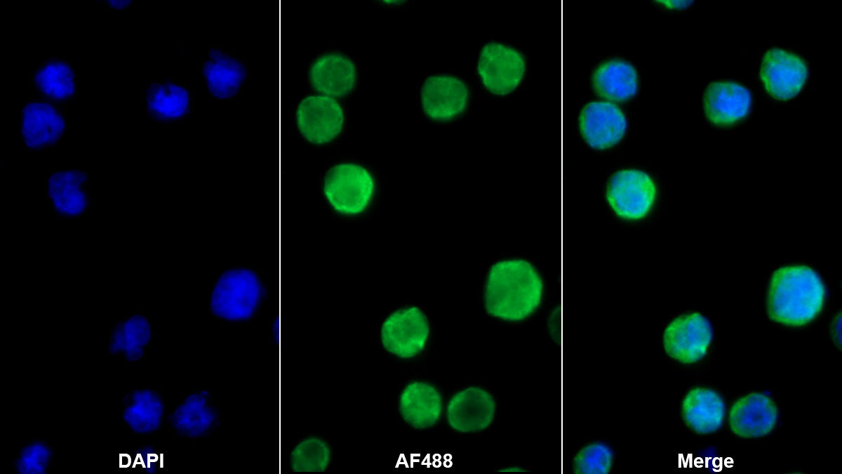 Polyclonal Antibody to Interleukin 4 (IL4)