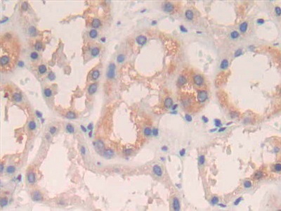 Polyclonal Antibody to Interleukin 4 (IL4)